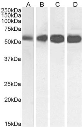 Antibody Validation