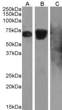 SB-10-3003 anti-BSA (0.3µg/ml) staining of Buffalo Serum (A), Human Serum (B) and Rabbit Serum (C))(5µg protein in RIPA buffer). Primary incubation was 1 hour. Detected by chemiluminescence.