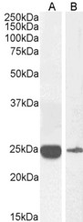 SB-20-3004 anti-CRP (0.3µg/ml) staining of Human Liver (A) and Human Serum (B) lysates (35µg protein in RIPA buffer). Primary incubation was 1 hour. Detected by chemiluminescence