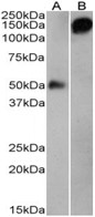 SB-50-3001 Anti-human IgG (1:3000) staining of human plasma either reduced (A) or nonreduced (B) (0.1µg protein per lane). Primary incubation was 1 hour. Detected by chemiluminescence