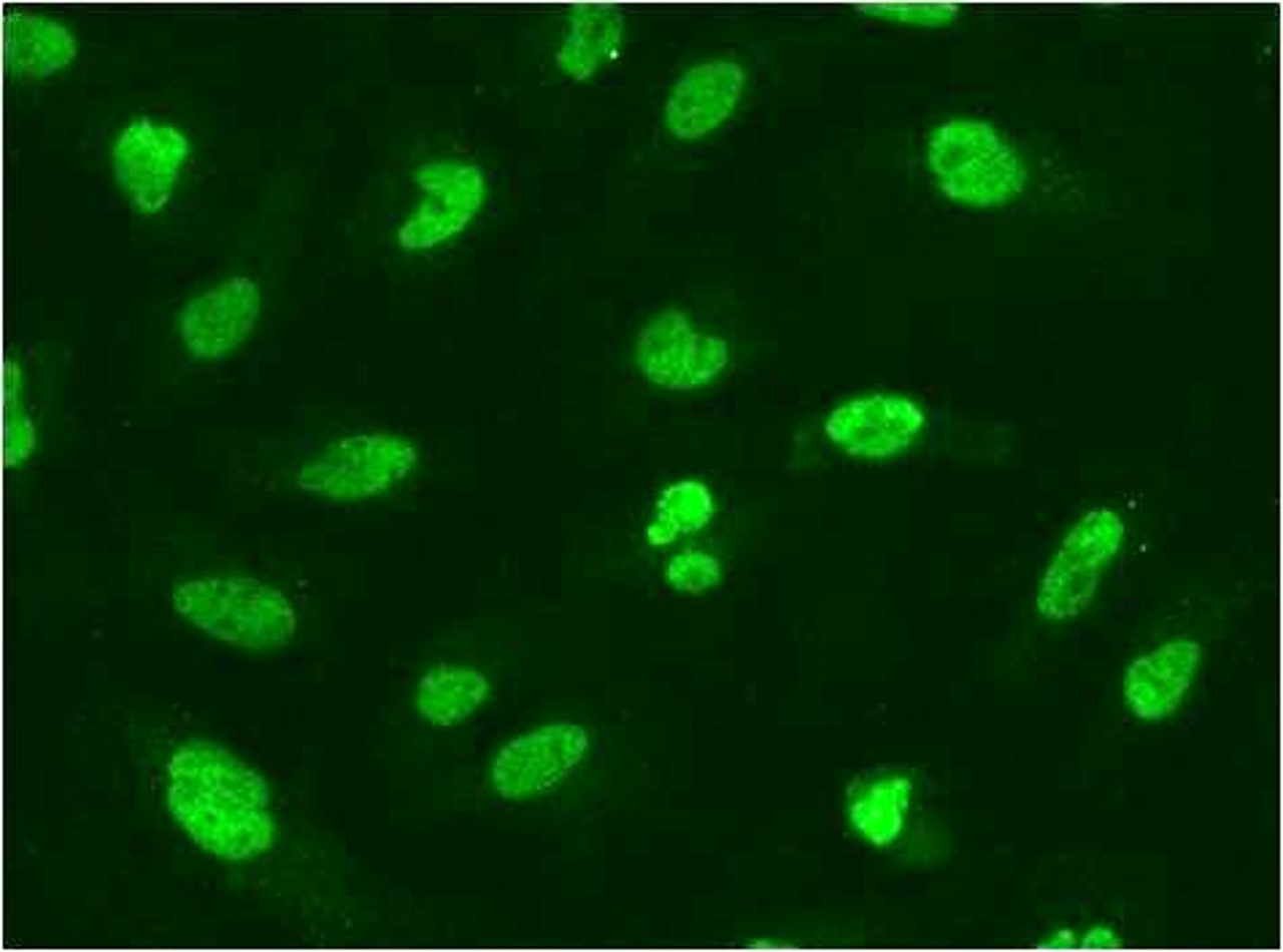 Immunofluorescence analysis of
HeLa cells attached on PDL coated
coverslip