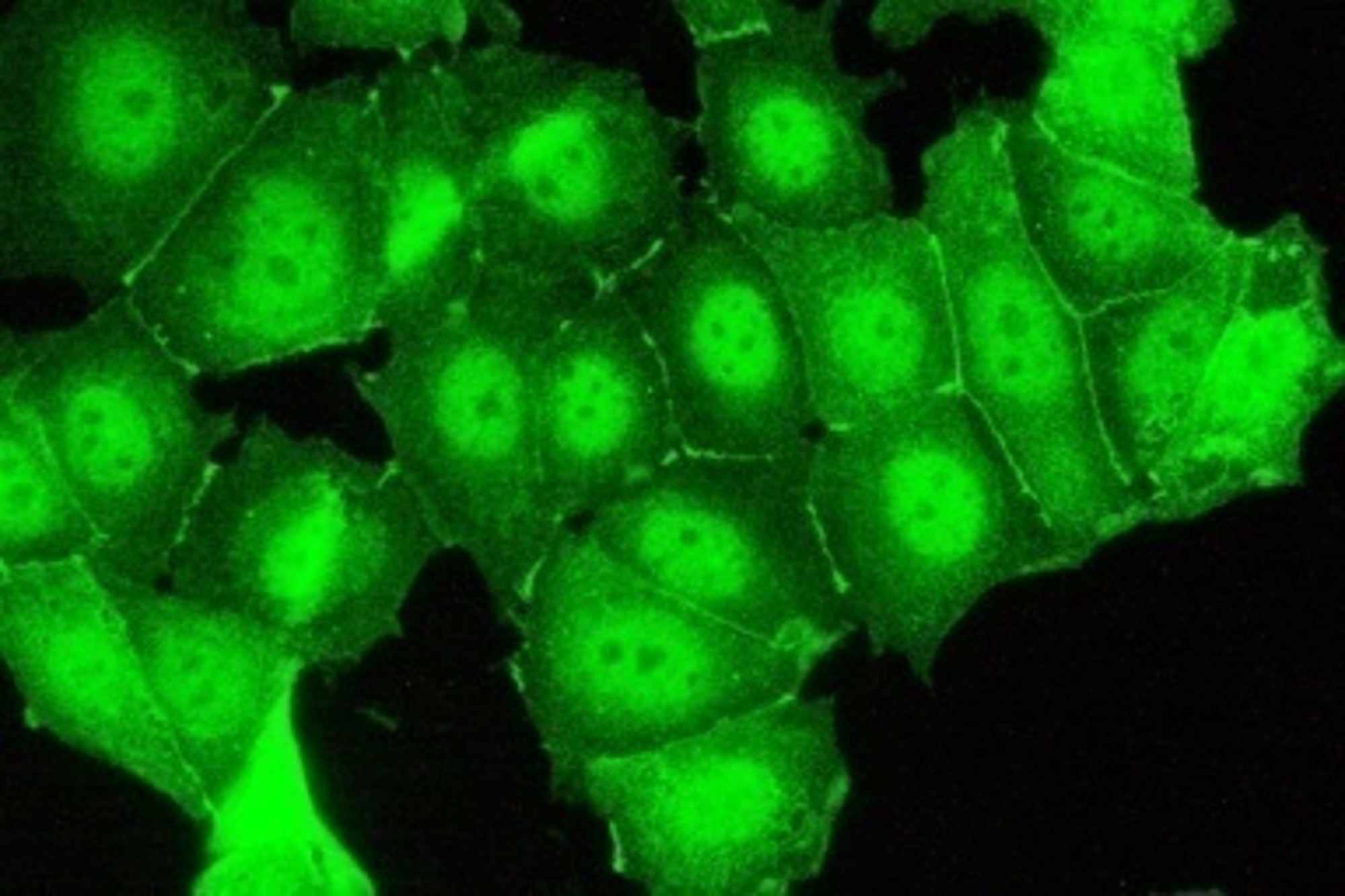 Immunofluorescence analysis of
MCF7 cells attached on PLL coated
coverslip