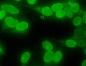 SB-50-3001F Anti-human IgG-FITC (1:100) staining of HeLa cells. Human serum (1:160) was used as primary antibody in HeLa cells.