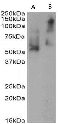 SB-51-3001 Anti-rabbit IgG (1:3000) staining of rabbit IgG either reduced (A) or nonreduced (B) (0.5µg protein per lane, A and 0.05 µg protein per lane, B). Primary incubation was 1 hour. Detected by chemiluminescence