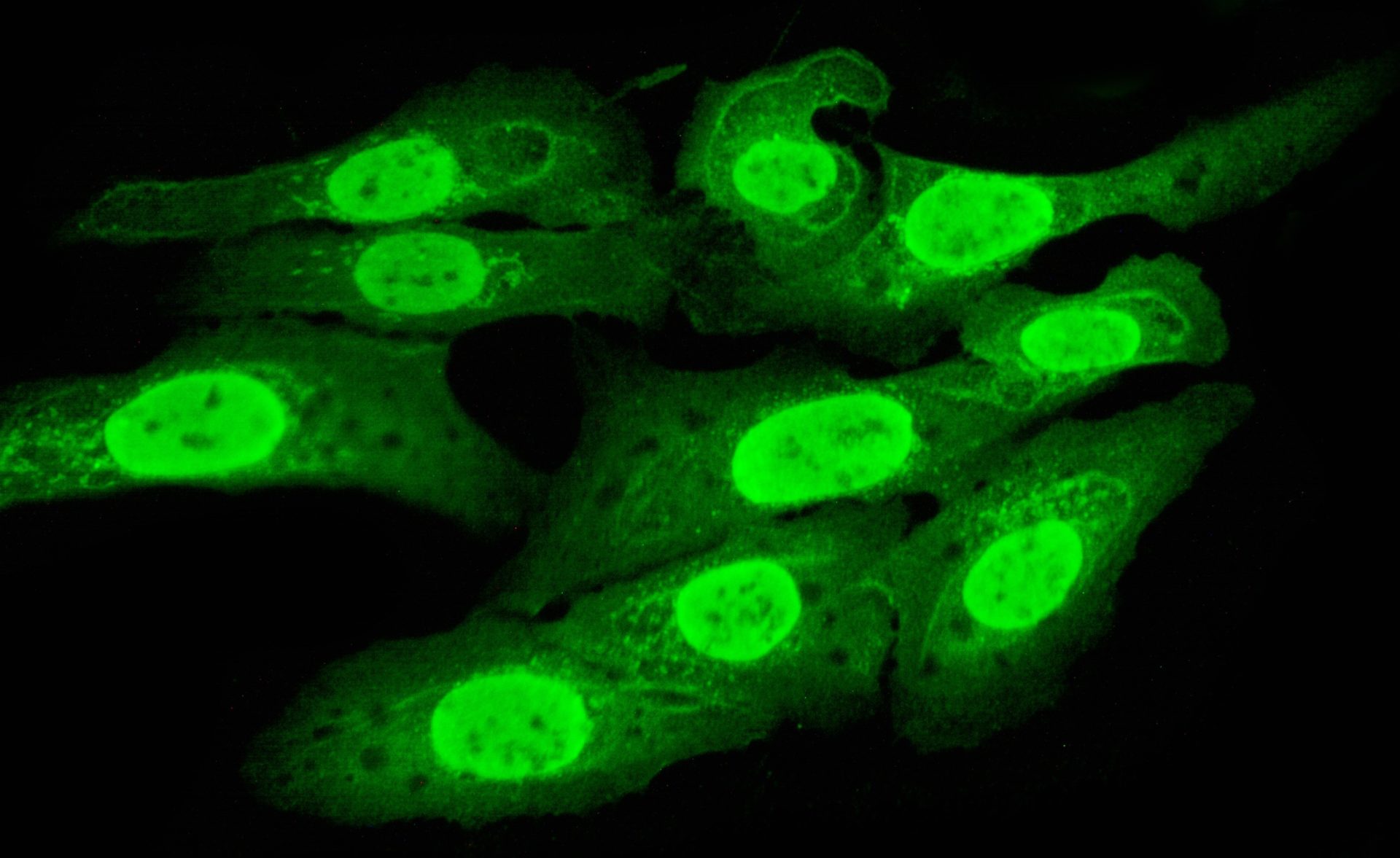 PLL Coated Coverslips Shikharbiotech pll-coated-coverslips-shikharbiotech