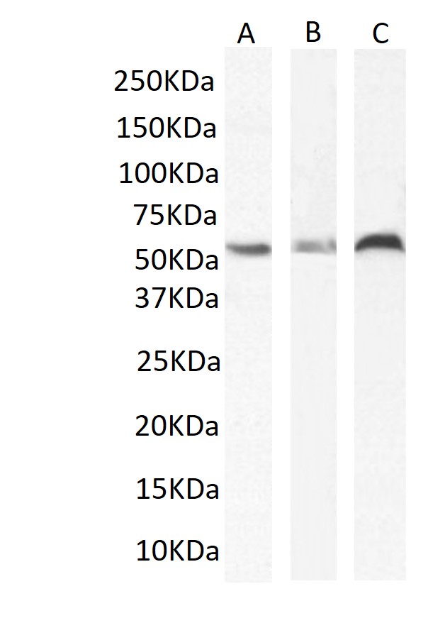 SB-AAA (2-3 µg/ml)  staining of MDA-MB-231 (A), Hek293T (B) and A431 (C) cell lysate (35 µg protein in RIPA buffer). Primary incubation was 1 hour. Detected by chemiluminescence