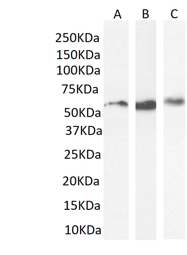 SB-AAB (0.3-1 µg/ml)  staining of MDA-MB-231 (A), Hek293T (B) and A431 (C) nuclear cell lysates (35 µg protein in nuclear extraction buffer). Primary incubation was 1 hour. Detected by chemiluminescence