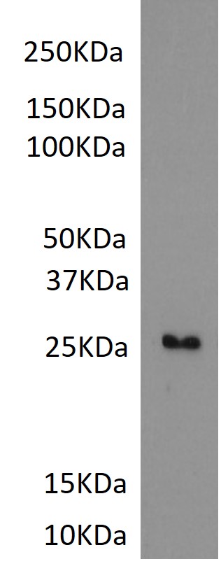 SB-AAG anti-CRP (1 µg/ml) staining of purified human CRP( 5µg protein in PBS). Primary incubation was 1 hour. Detected by chemiluminescence